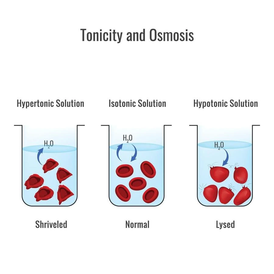 This diagram shows the effect of hypertonic solution, hypotonic solution, and isotonic solution over cells.