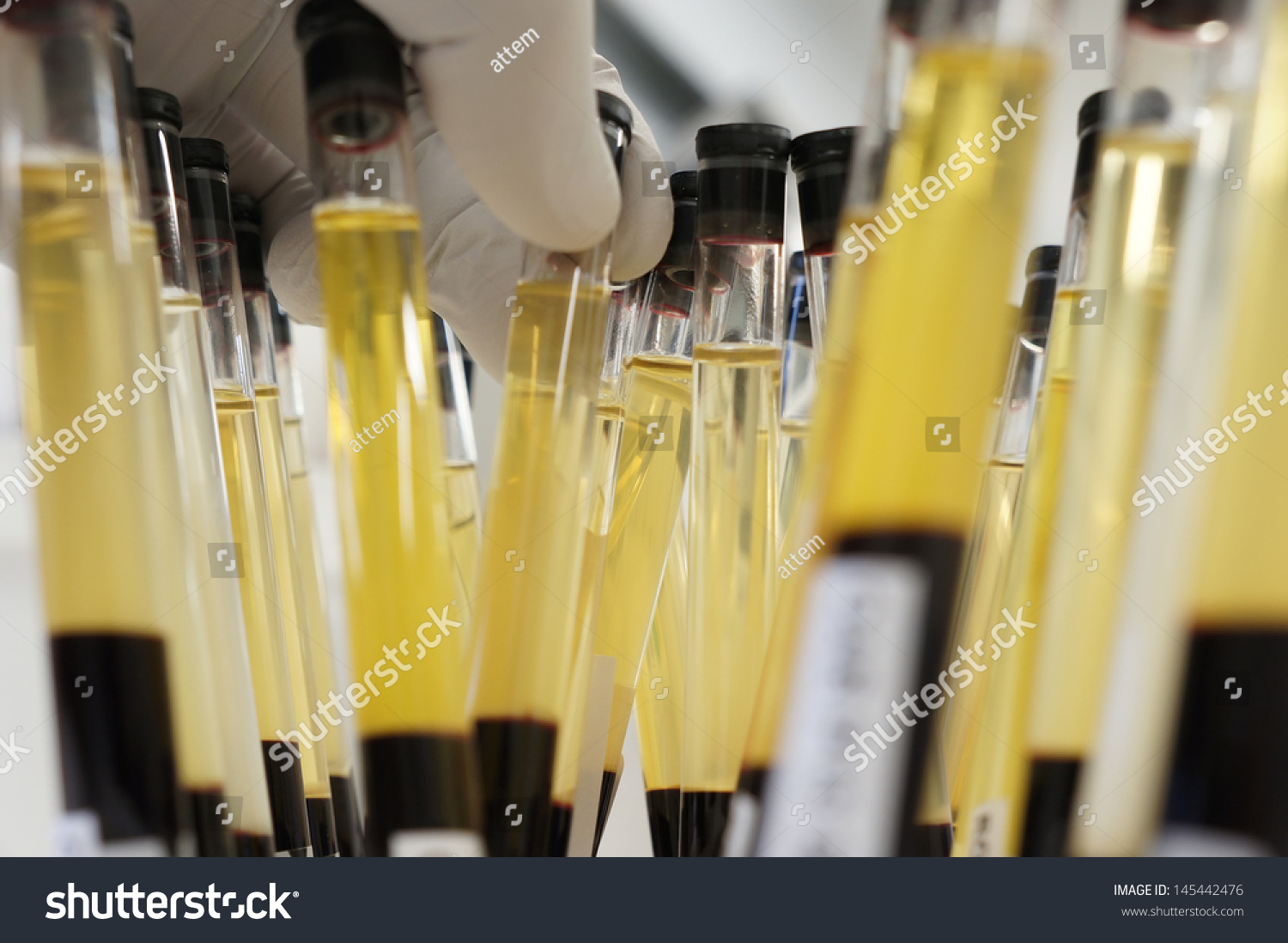 Hand picking out test tubes filled with serum - erythrocyte
